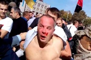 В Одессе Шуфрича жестоко избили (+Видео)