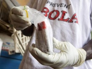 В США вводят карантин в связи с вирусом Эбола