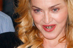 Мадонна шокировала своими зубами (фото)