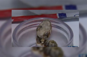В США женщина нашла в банке фасоли голову змеи
