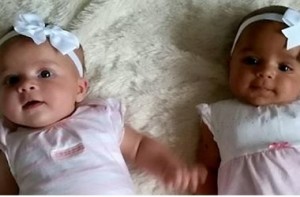 В Англии родились близнецы с разным цветом кожи