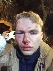 В Одессе напали на украинского певца