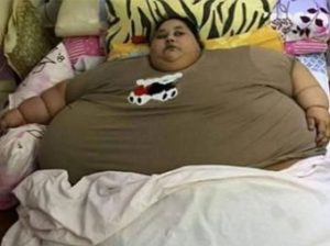 Самая толстая женщина в мире похудела на 140 килограммов (+Видео)