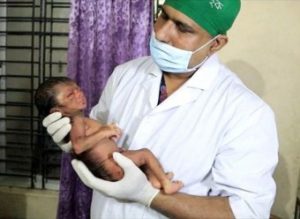 Бенджамин Баттон XXI: в Бангладеше родился младенец-старик (+Фото)