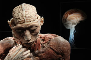 Человеку с «мертвым» мозгом вернули сознание