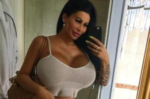В Германии женщина сделала себе гигантскую грудь