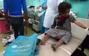 В Йемене авиация обстреляла автобус с детьми: 39 погибших