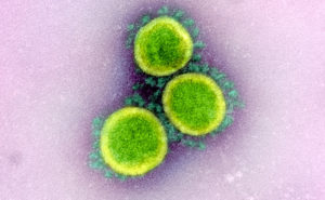 Новые снимки коронавируса SARS-CoV-2 под электронным микроскопом
